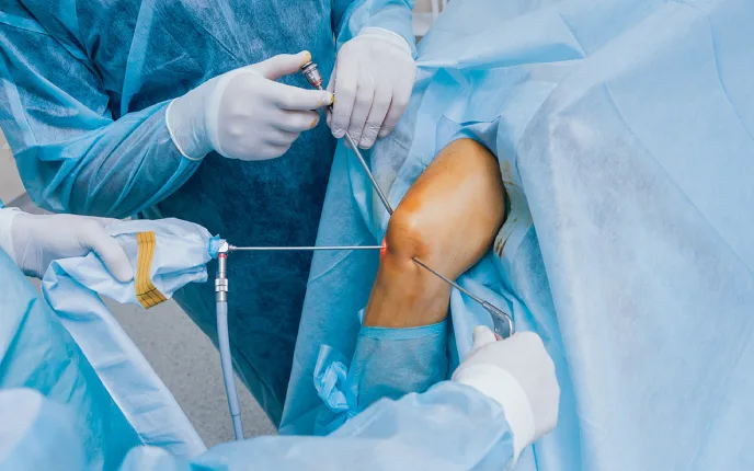 Knee Surgery Arthroscopy in Dubai, UAE - Dr. Azam Badar Khan