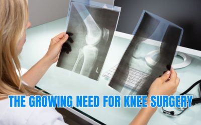 The Growing Need for Knee Surgery
